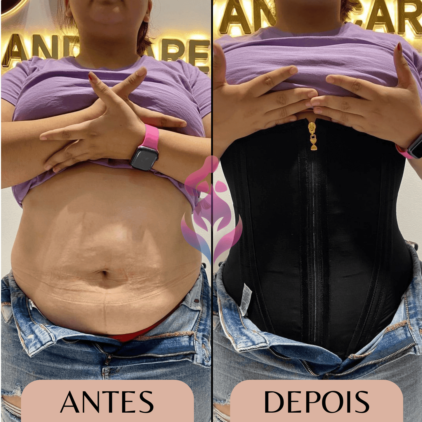 Cinta Modeladora Ursula - Alta Compressão - Isa Leblanc